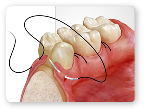 Chirurgie Operatii Dentare