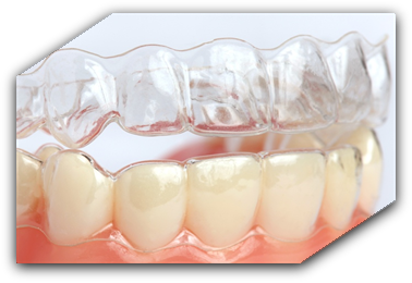 Aparate dentare tip gutiere Invisalign Clear Aligner