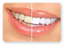 Estetica Dentara - Cabinet Ortodontie