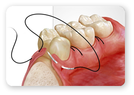 Chirurgie Orala