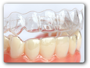Aparat dentar gutiere