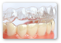 Aparat dentar tip gutiere,invisalign clear aligner